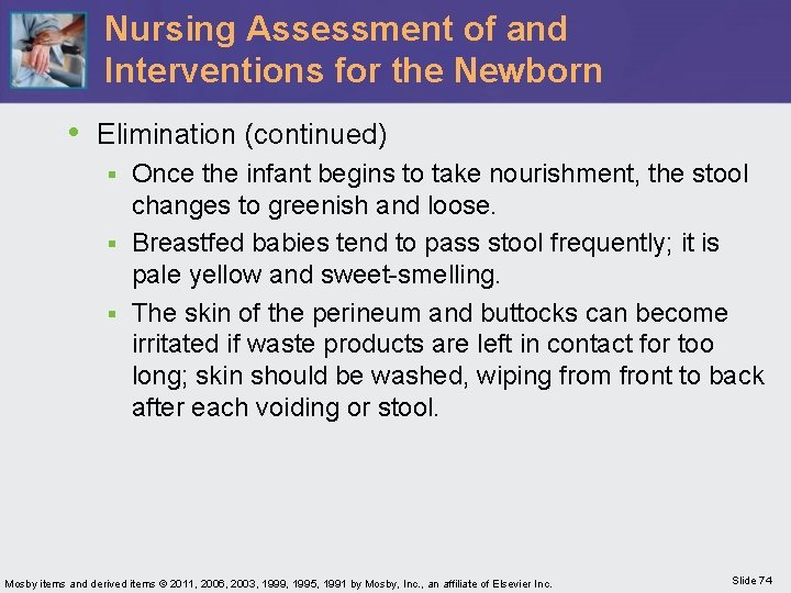 Nursing Assessment of and Interventions for the Newborn • Elimination (continued) Once the infant