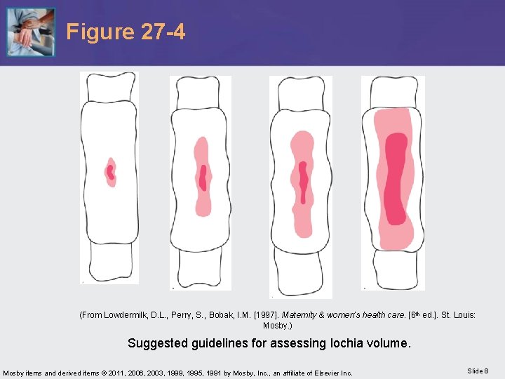 Figure 27 -4 (From Lowdermilk, D. L. , Perry, S. , Bobak, I. M.