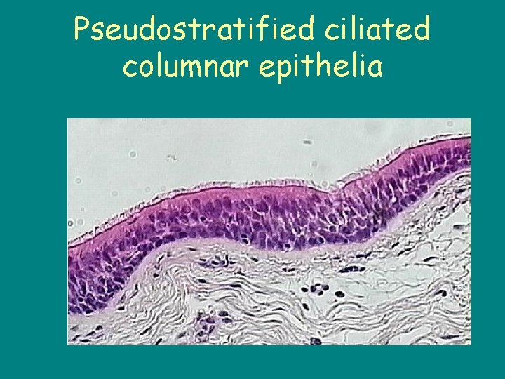 Pseudostratified ciliated columnar epithelia 