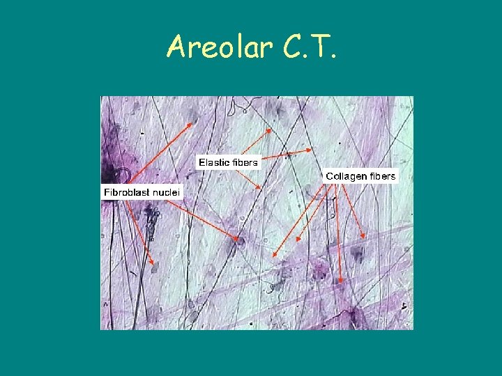 Areolar C. T. 