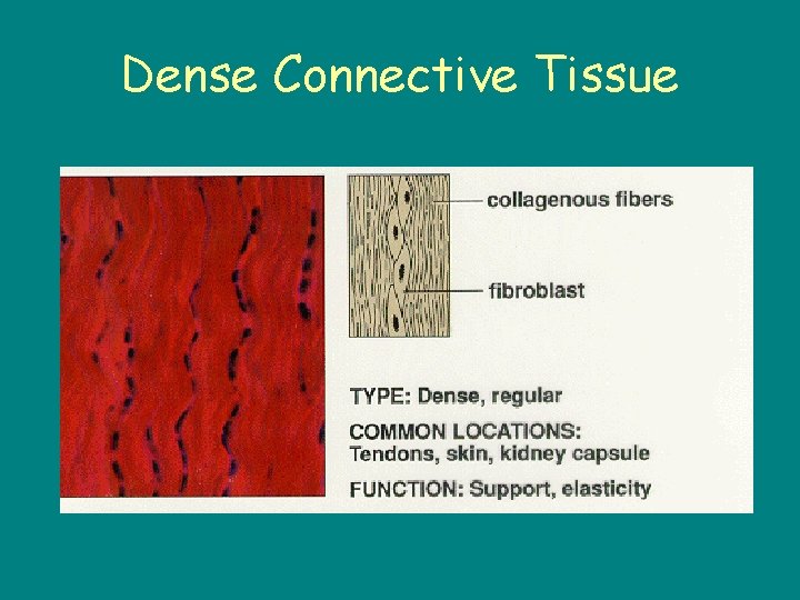 Dense Connective Tissue 