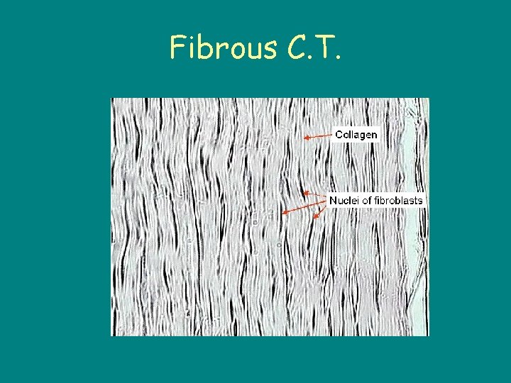 Fibrous C. T. 