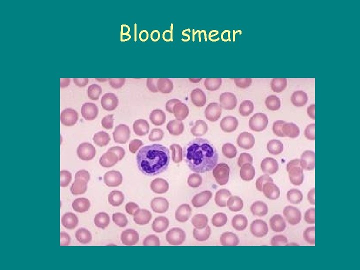 Blood smear 