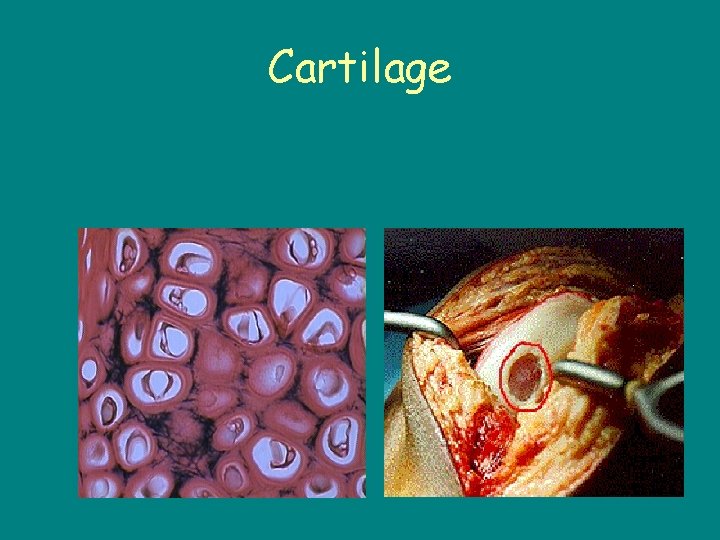 Cartilage 