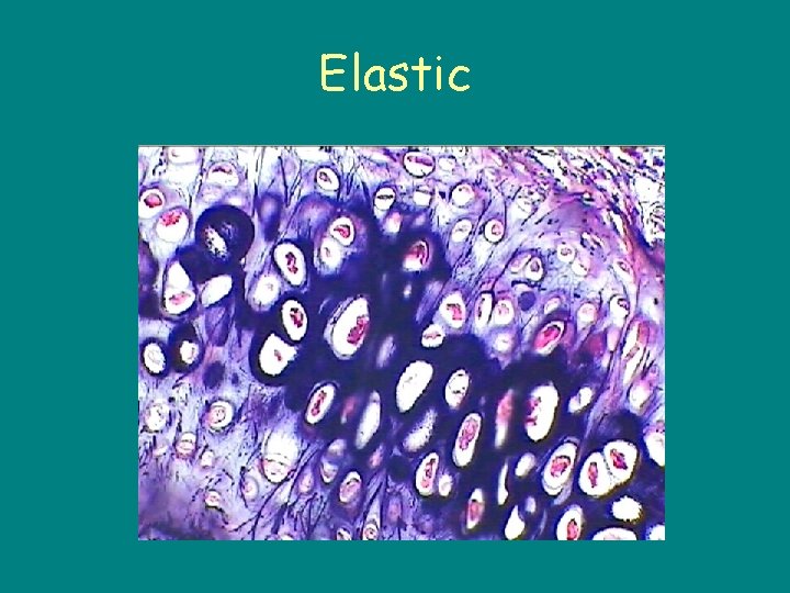 Elastic 