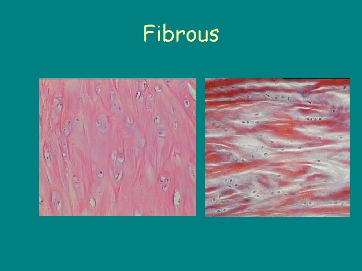 Fibrous 
