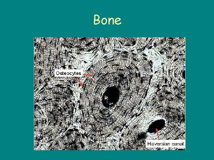 Bone 