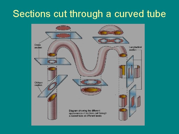 Sections cut through a curved tube 