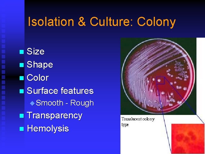 Isolation & Culture: Colony Size n Shape n Color n Surface features n u