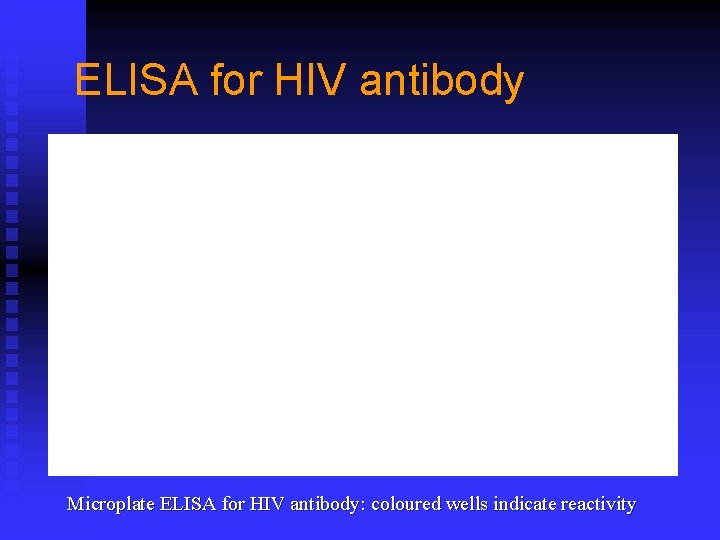 ELISA for HIV antibody Microplate ELISA for HIV antibody: coloured wells indicate reactivity 