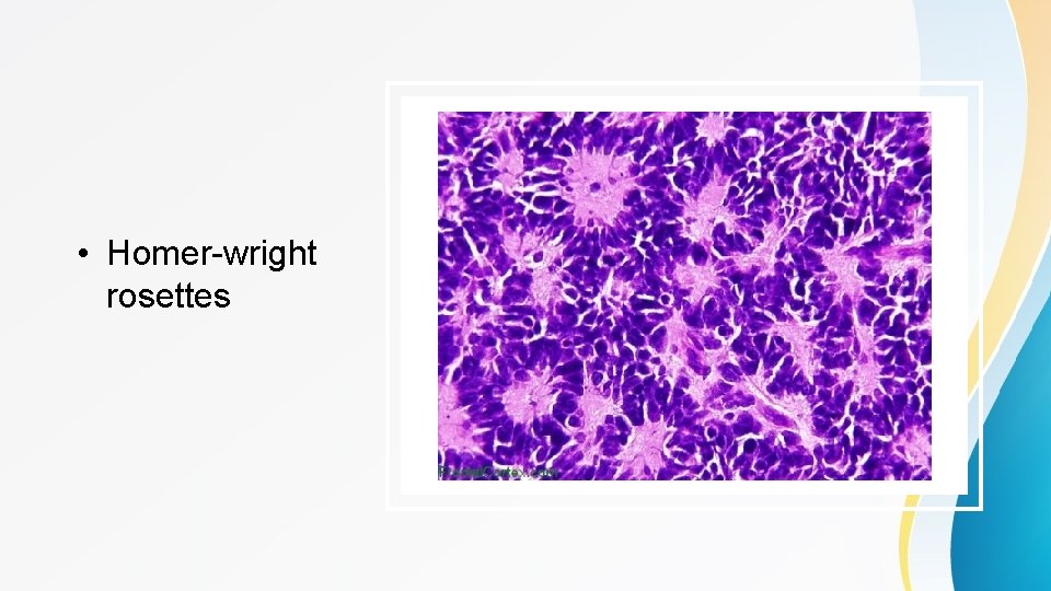  • Homer-wright rosettes 