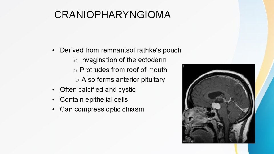 CRANIOPHARYNGIOMA • Derived from remnantsof rathke's pouch o Invagination of the ectoderm o Protrudes