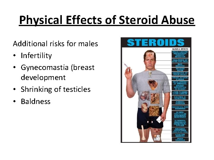 Physical Effects of Steroid Abuse Additional risks for males • Infertility • Gynecomastia (breast