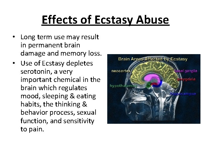 Effects of Ecstasy Abuse • Long term use may result in permanent brain damage