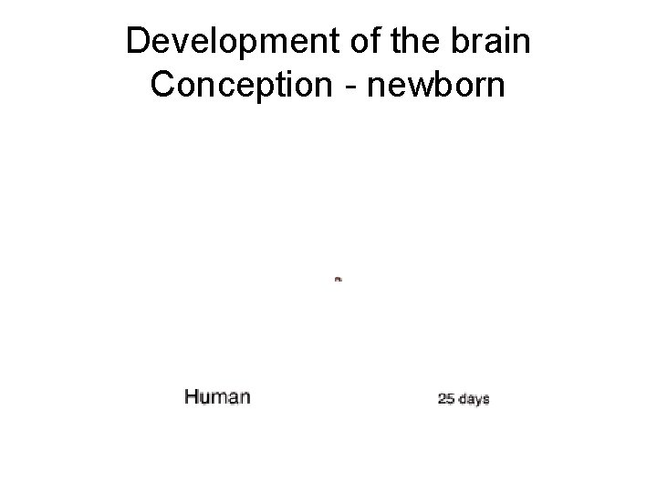 Development of the brain Conception - newborn 