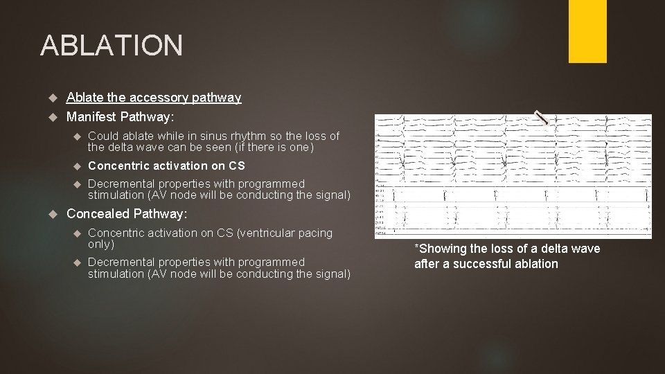 ABLATION Ablate the accessory pathway Manifest Pathway: Could ablate while in sinus rhythm so