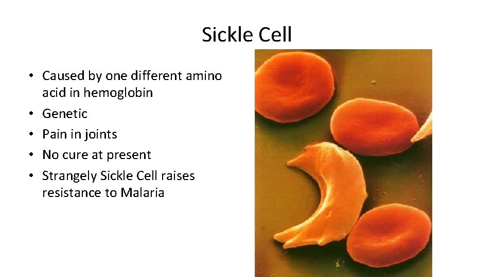 Sickle Cell • Caused by one different amino acid in hemoglobin • Genetic •