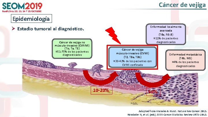 Cáncer de vejiga Epidemiología Enfermedad localmente avanzada (T 4 a, N 1 -3) ≈11%