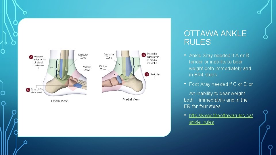 OTTAWA ANKLE RULES • Ankle Xray needed if A or B tender or inability