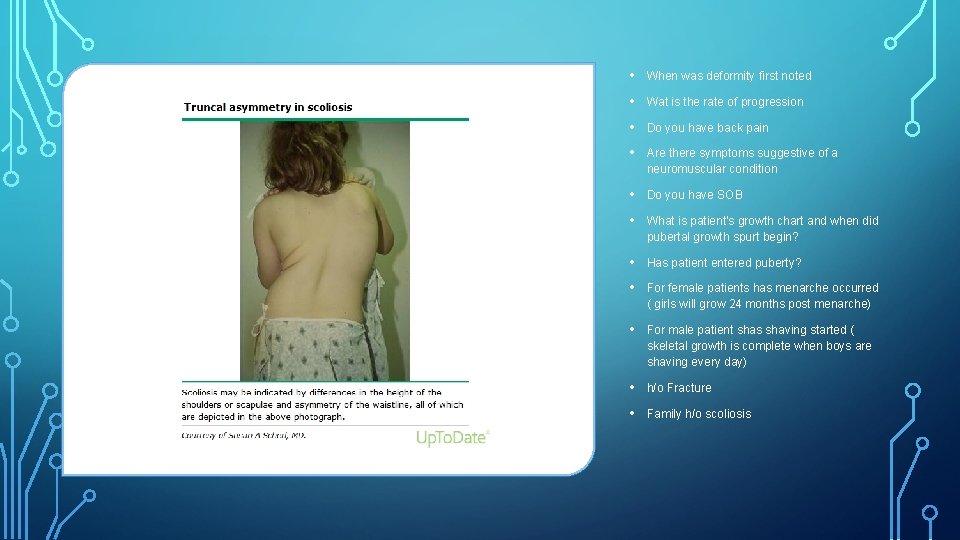  • When was deformity first noted • Wat is the rate of progression