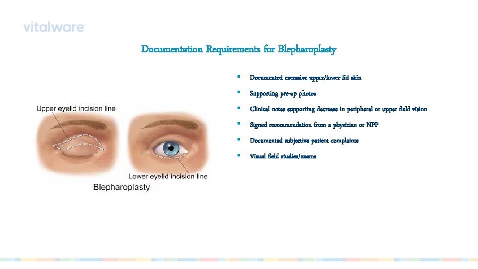 Documentation Requirements for Blepharoplasty § Documented excessive upper/lower lid skin § Supporting pre-op photos