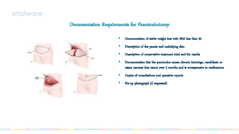 Documentation Requirements for Panniculectomy § Documentation of stable weight loss with BMI less than