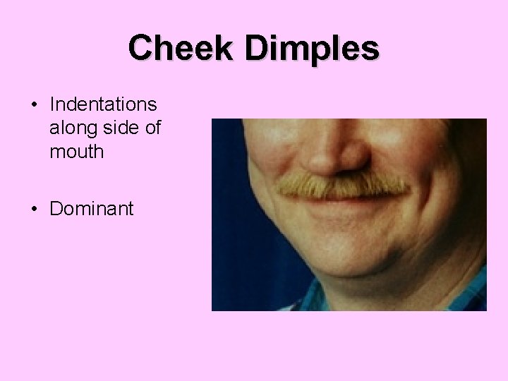 Cheek Dimples • Indentations along side of mouth • Dominant 