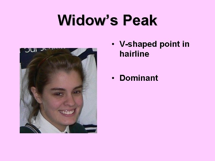 Widow’s Peak • V-shaped point in hairline • Dominant 