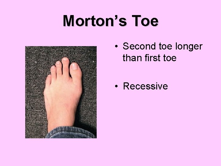 Morton’s Toe • Second toe longer than first toe • Recessive 