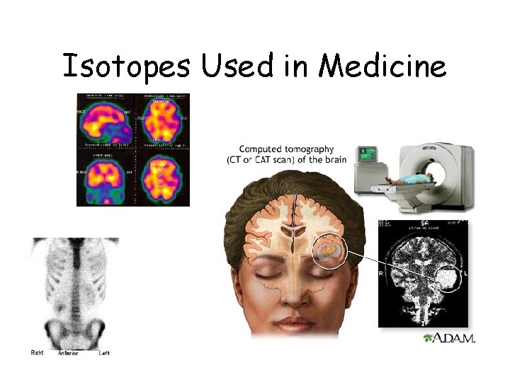 Isotopes Used in Medicine 