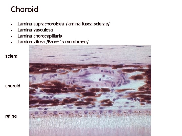 Choroid • • Lamina sclera choroid retina suprachoroidea /lamina fusca sclerae/ vasculosa chorocapillaris vitrea