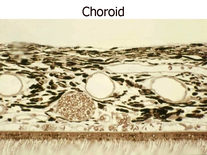 Choroid 