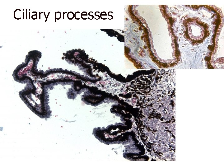 Ciliary processes 