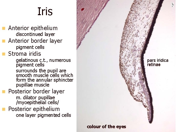 Iris n Anterior epithelium – discontinued layer n Anterior border layer – pigment cells