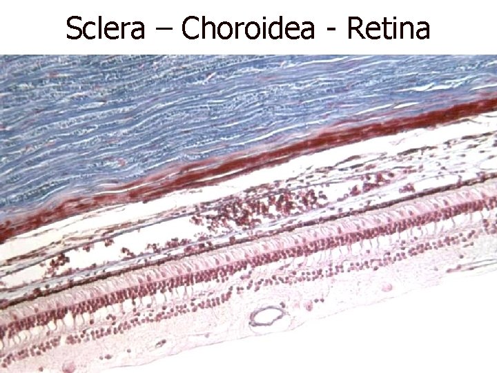 Sclera – Choroidea - Retina 