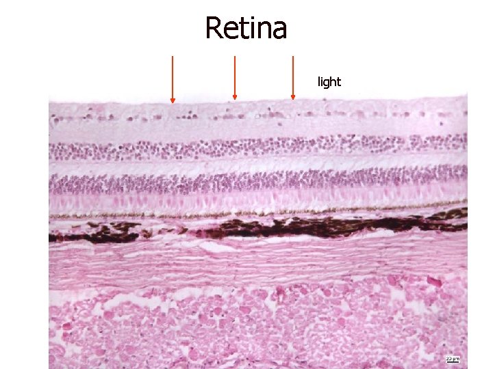 Retina light 