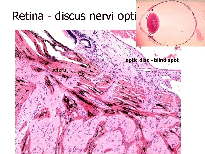Retina - discus nervi optic disc - blind spot sclera 