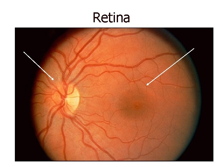 Retina 