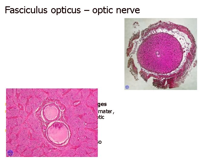 Fasciculus opticus – optic nerve is surrounded by the three meninges n c. t.