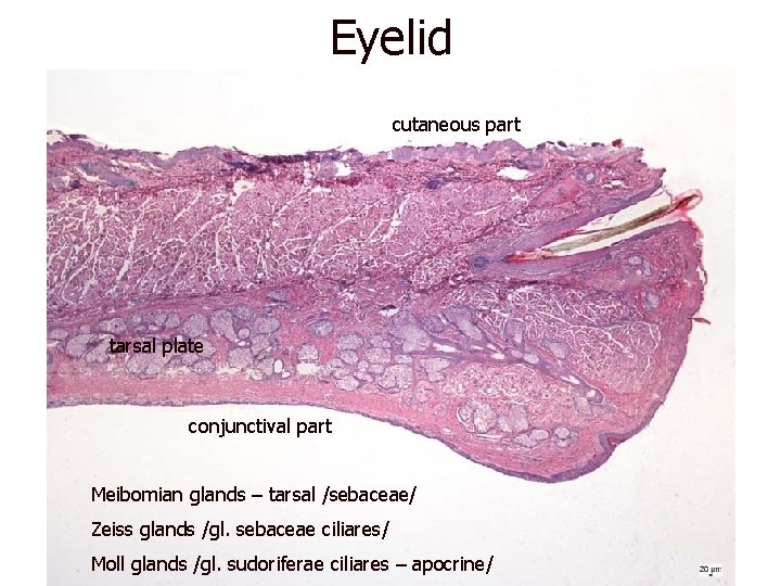 Eyelid cutaneous part tarsal plate conjunctival part Meibomian glands – tarsal /sebaceae/ Zeiss glands