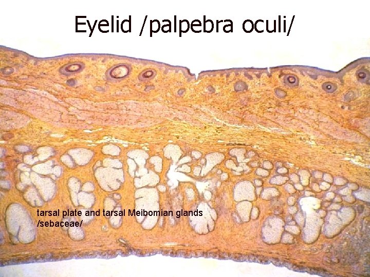 Eyelid /palpebra oculi/ tarsal plate and tarsal Meibomian glands /sebaceae/ 