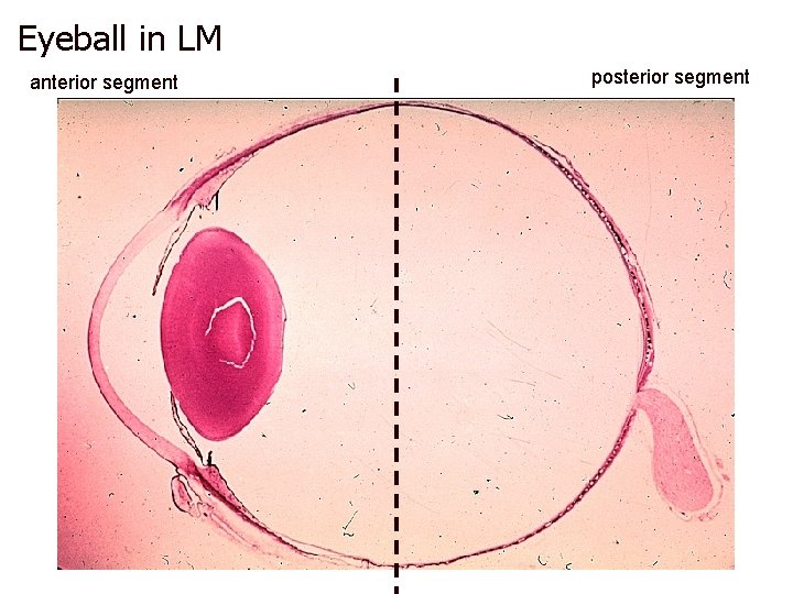 Eyeball in LM anterior segment posterior segment 