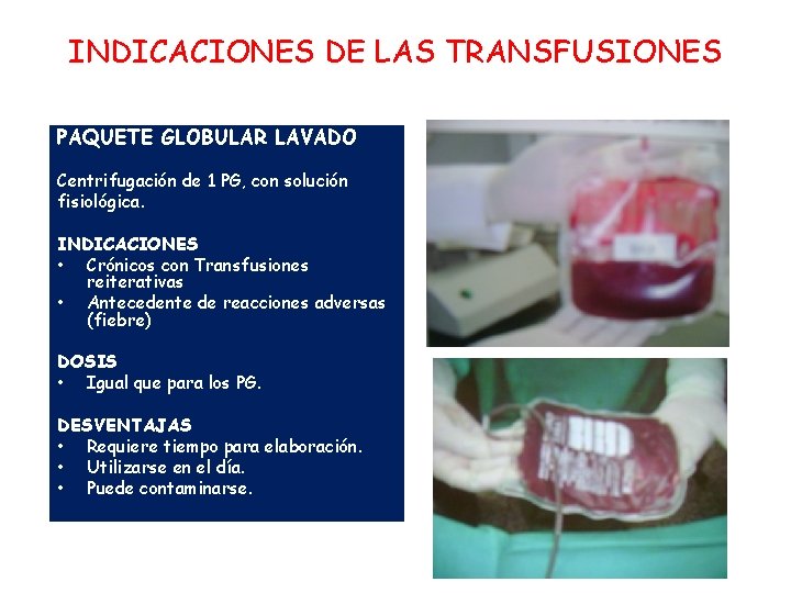 INDICACIONES DE LAS TRANSFUSIONES PAQUETE GLOBULAR LAVADO Centrifugación de 1 PG, con solución fisiológica.