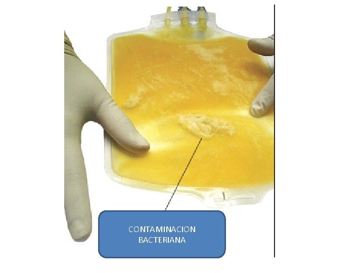 CONTAMINACION BACTERIANA 