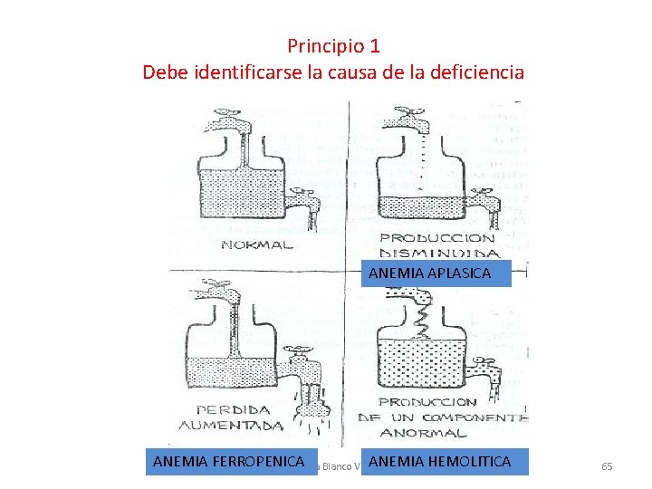 Principio 1 Debe identificarse la causa de la deficiencia ANEMIA APLASICA ANEMIA FERROPENICA ANEMIA