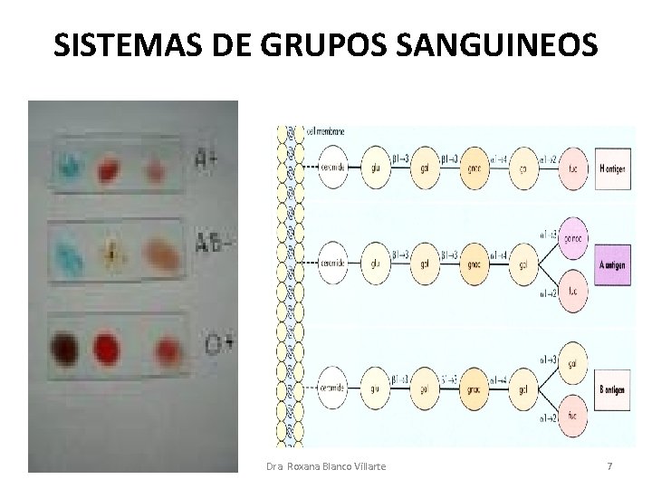 SISTEMAS DE GRUPOS SANGUINEOS Dra. Roxana Blanco Villarte 7 