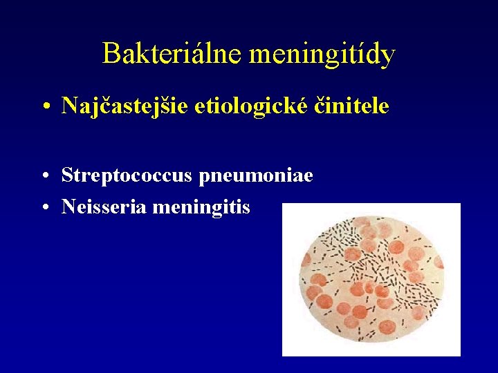 Bakteriálne meningitídy • Najčastejšie etiologické činitele • Streptococcus pneumoniae • Neisseria meningitis 