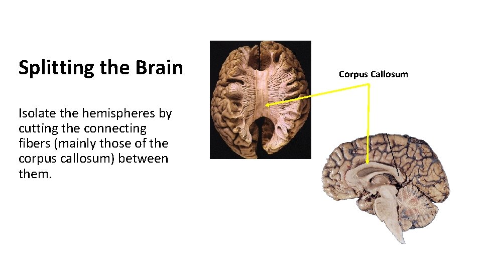Splitting the Brain Isolate the hemispheres by cutting the connecting fibers (mainly those of Splitting the Brain Isolate the hemispheres by cutting the connecting fibers (mainly those of