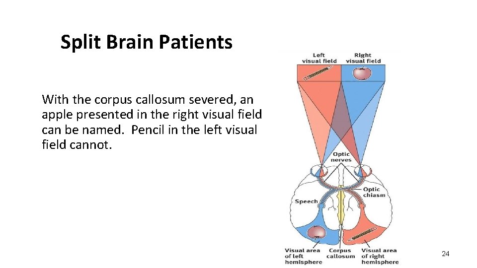 Split Brain Patients With the corpus callosum severed, an apple presented in the right Split Brain Patients With the corpus callosum severed, an apple presented in the right