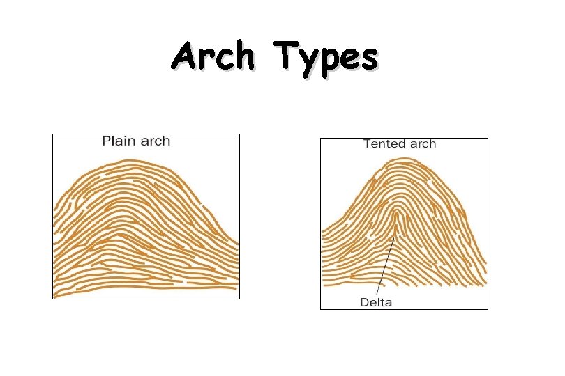 Arch Types * 